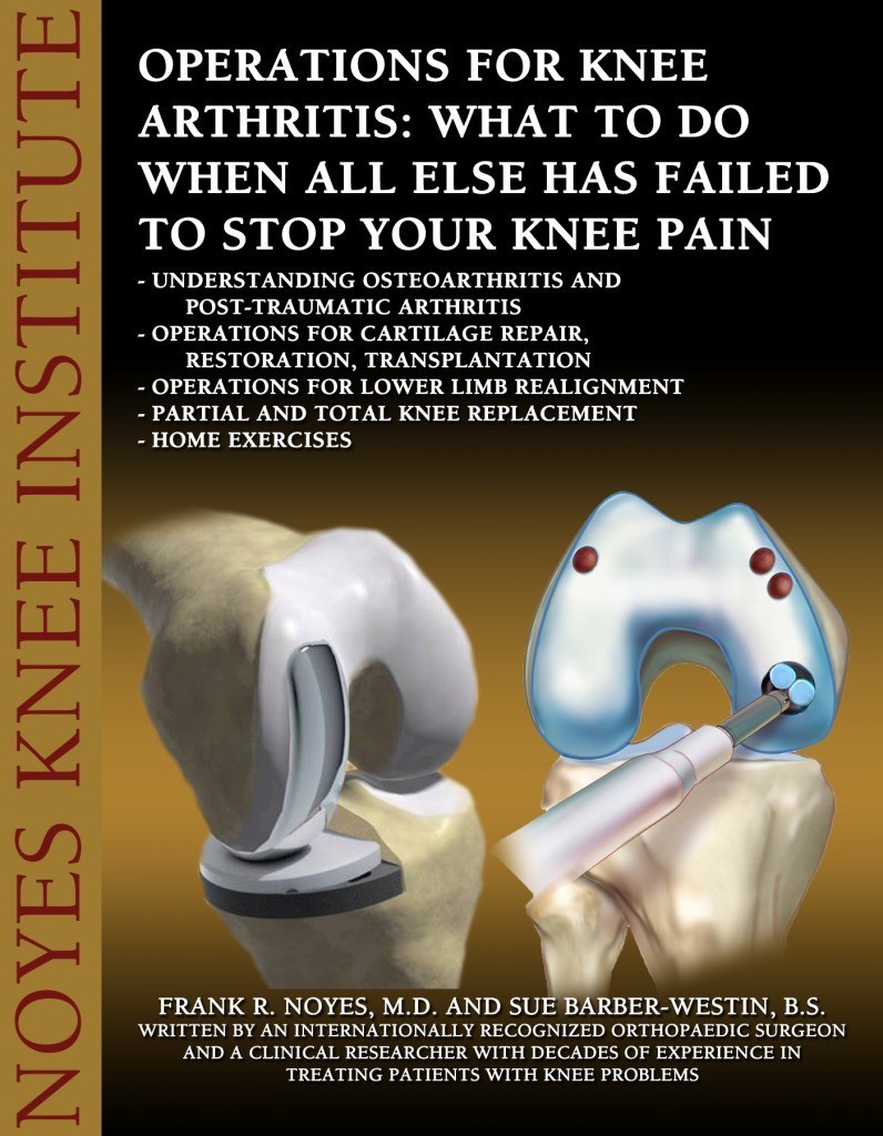 Operations for Knee Arthritis